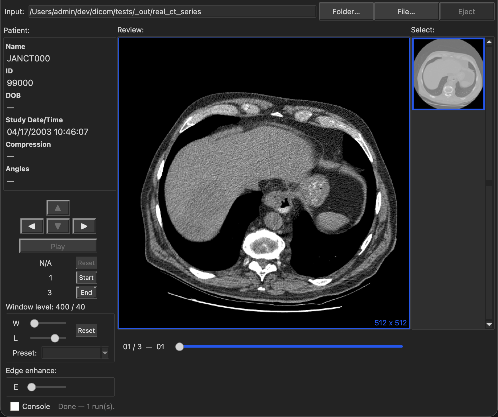 MacAngioView stepping through a real 3-slice CT/CTA series, window-leveled with the SOFT TISSUE preset