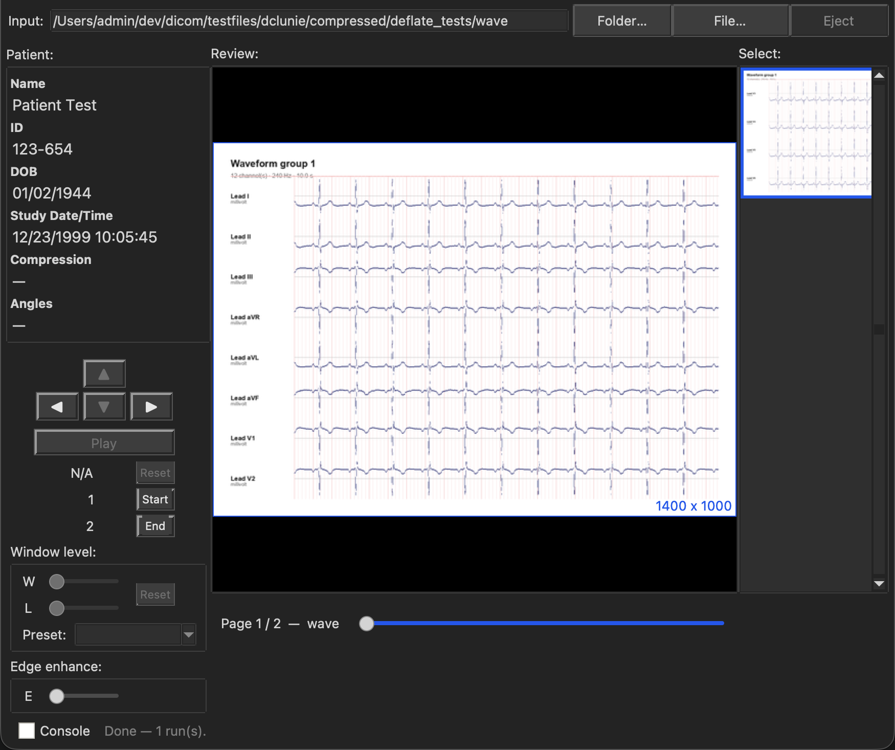 MacAngioView rendering a real 12-lead ECG Waveform Storage instance as a paginated lead-strip